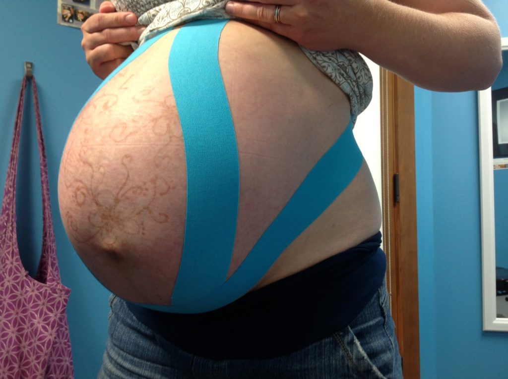 Kinesiology Tape During Pregnancy