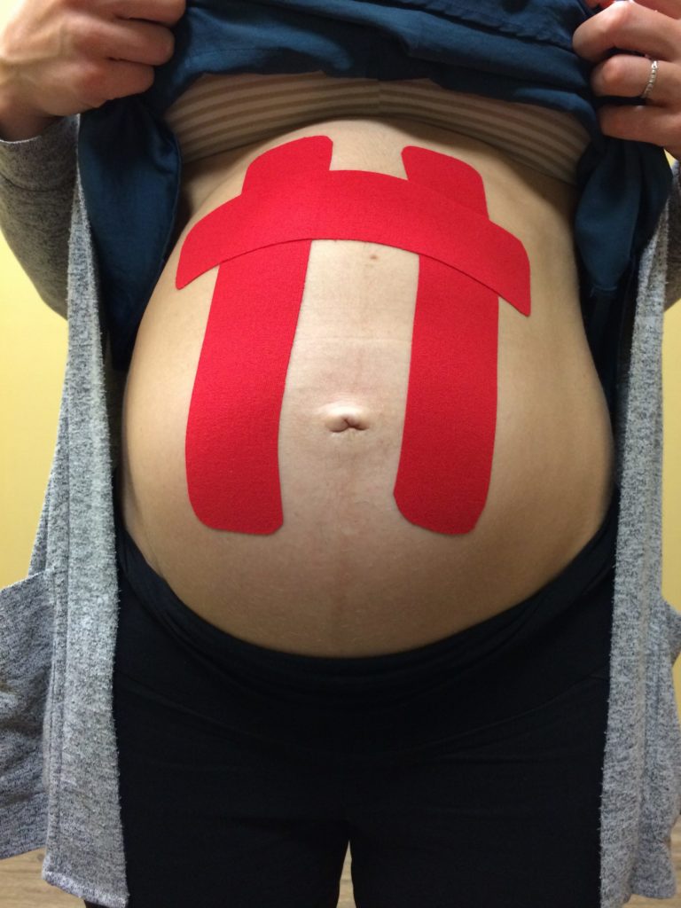 Kinesio Tape During Pregnancy — EnerG Health Solutions