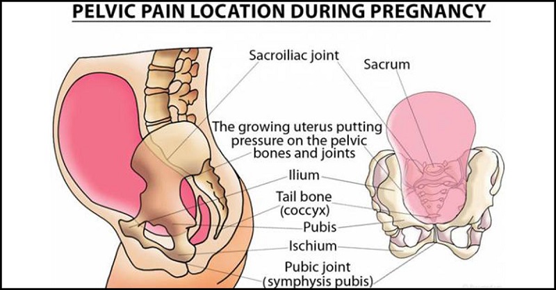 Impact on the pelvic floor