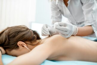 Acupuncture medical treatment AltaVie Health Kelowna